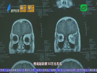 女孩患脑瘤 期望获救助
