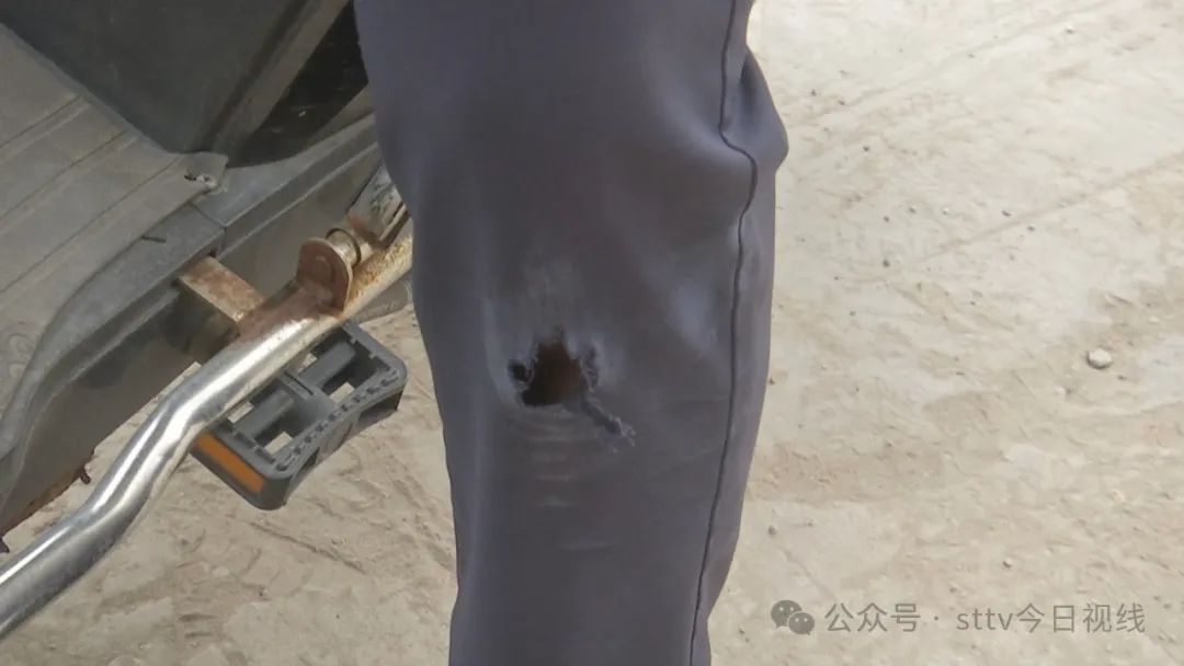 沙石散落路面  “骑士”不慎摔倒